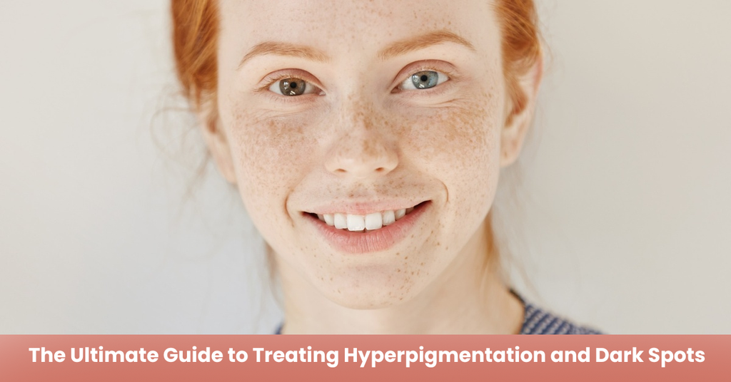 Causes, Effective Treatments, and Expert-Backed Solutions for Clear, Even-Toned Skin